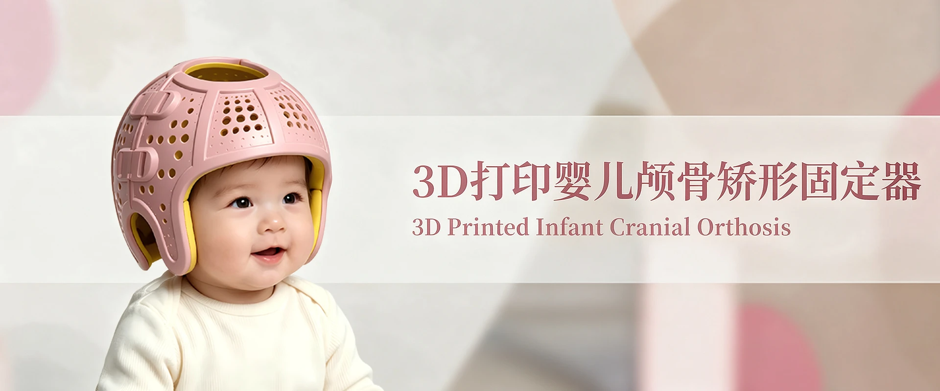打印婴儿颅骨矫形固定器2